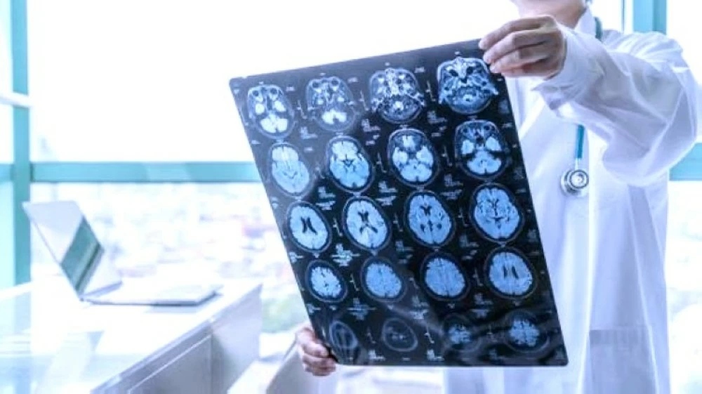 قطرات أنف نانوية تفتح أفقاً جديداً لعلاج السرطان قطرات أنف نانوية تفتح أفقاً جديداً لعلاج السرطان