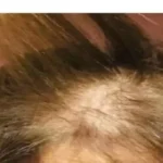 فنانة مصرية تفقد شعرها بعد جلسة تجميل فاشلة