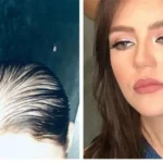 بعد مأساة رحمة حسن.. «عكاظ» ترصد فنانات وقعن في فخ عمليات التجميل!