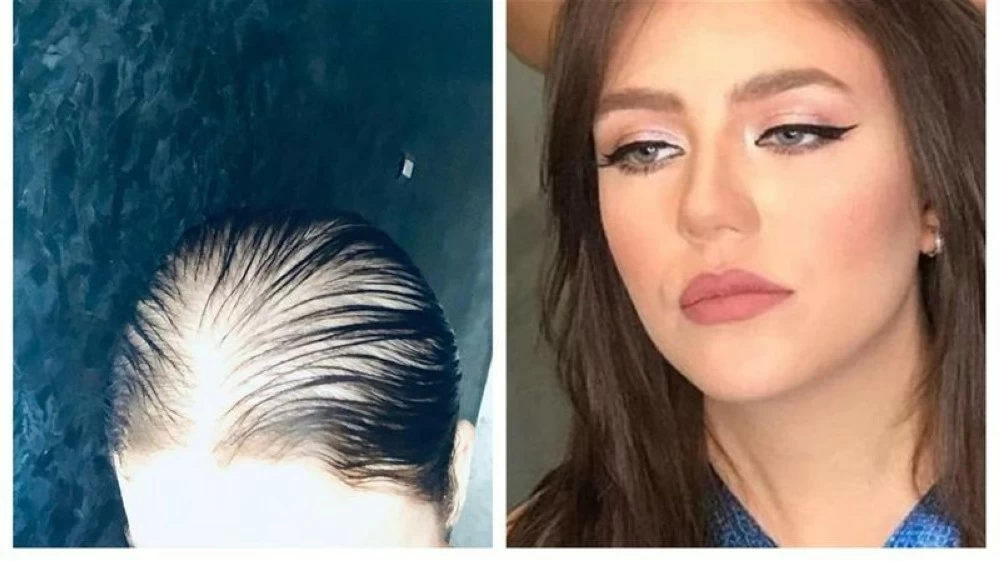 بعد مأساة رحمة حسن.. «عكاظ» ترصد فنانات وقعن في فخ عمليات التجميل! بعد مأساة رحمة حسن.. «عكاظ» ترصد فنانات وقعن في فخ عمليات التجميل!