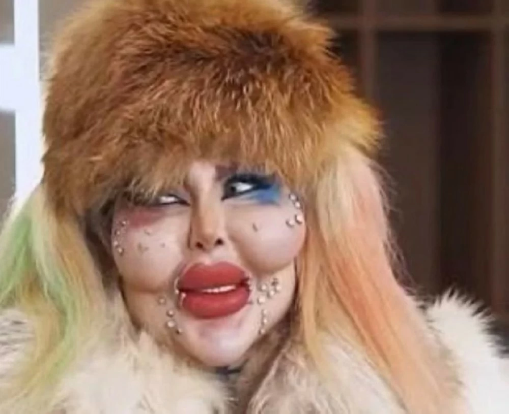 مؤثرة إيرانية تجري 388 عملية تجميل ب50 مليون دولار.. والنتيجة صادمة! مؤثرة إيرانية تجري 388 عملية تجميل ب50 مليون دولار.. والنتيجة صادمة!