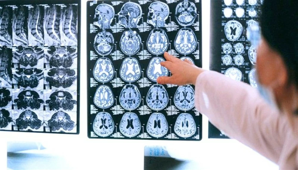 نتائج واعدة لمكملات غذائية في إبطاء نمو أورام سرطان الدماغ نتائج واعدة لمكملات غذائية في إبطاء نمو أورام سرطان الدماغ