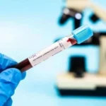 اختبار دم ينقذ حياة ملايين المصابين باعتلال عضلة القلب الوراثي