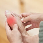 المصدر الحقيقي للنقرس