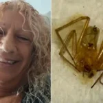 عناكب منزلية سامة تبتر أصابع مستأجرة أمريكية