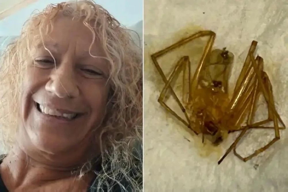 عناكب منزلية سامة تبتر أصابع مستأجرة أمريكية