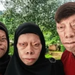 عائلة تشبه «السحالي» تجني المال من مظهرها