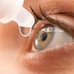 متلازمة جفاف العين.. مرض صامت يؤثر على الدموع والمشاعر