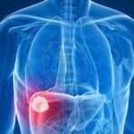 5 علامات صامتة تنذر بمشكلة صحية خطيرة