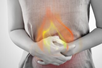 كيفية التخلص من حرقة المعدة المستمرة دون أدوية