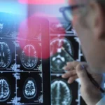 دراسة أمريكية تحذّر: خطر الخرف يتضاعف 4 مرات لدى «كبار السن»