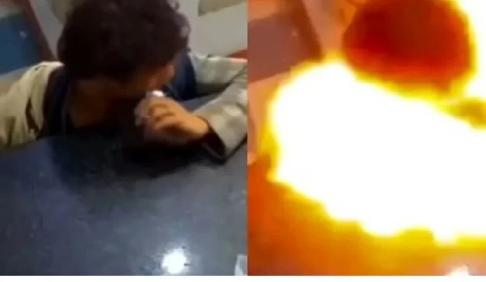 مراهق «يعضّ بطارية» فتنفجر داخل فمه وتحرق وجهه مراهق «يعضّ بطارية» فتنفجر داخل فمه وتحرق وجهه