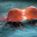 باحثون يابانيون يطورون نظاما للكشف عن سرطان عنق الرحم