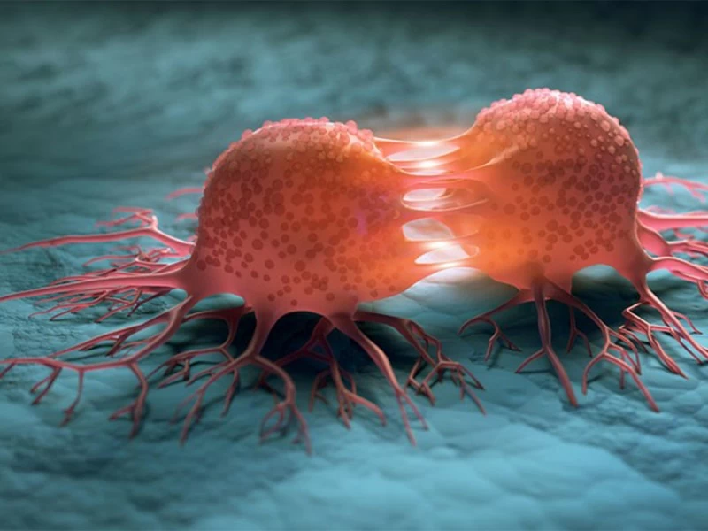 باحثون يابانيون يطورون نظاما للكشف عن سرطان عنق الرحم