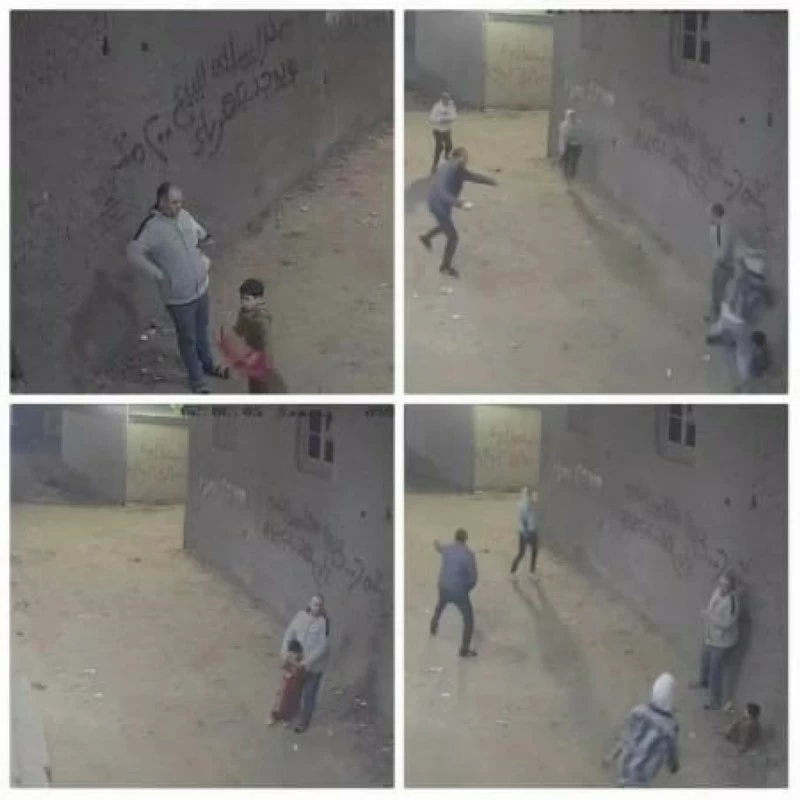 مصر: بعد هجوم غادر على أب وطفله.. إنقاذ ساق محمد من البتر في «واقعة باسوس»