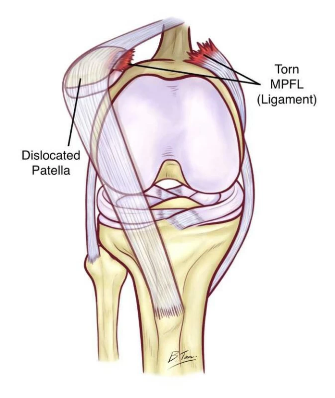 الشهراني يكشف تفاصيل إصابة اللاعب حمد اليامي الشهراني يكشف تفاصيل إصابة اللاعب حمد اليامي