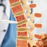 6 أطعمة تحميك من هشاشة العظام مع التقدم في العمر