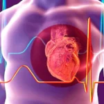 كيف تتجنّب أسباب «موت الفجأة»!