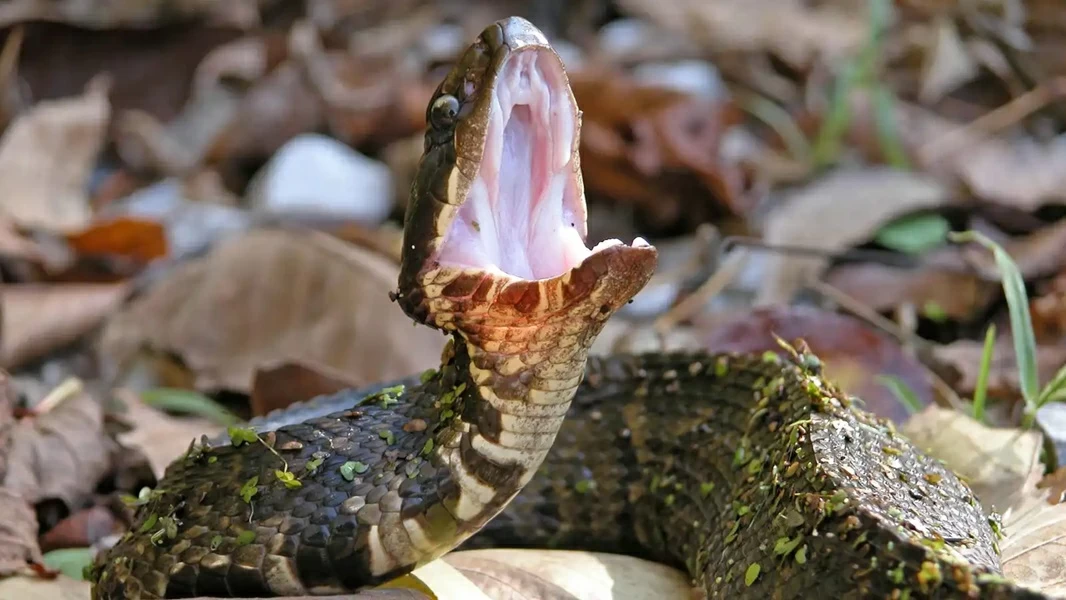 صرخة في شهر العسل تكشف مرضاً قاتلاً.. و«العريس» على جهاز تنفس بانتظار معجزة