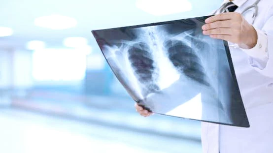 آلية جديدة تفتح باب علاج أكثر فاعلية لمرض السل آلية جديدة تفتح باب علاج أكثر فاعلية لمرض السل