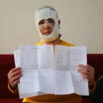 هرب منها ابنها.. «وجه الأميرة» يحترق في مركز تجميل تركي