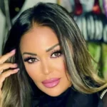 بعد العملية.. داليا البحيري تظهر بملامح أقرب لفيلم «سنة أولى نصب»