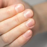 لا تتجاهلها.. علامة في أظافرك تكشف صحتك وتحذر من أمراض صامتة