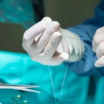 طاولة التجميل تبتلع طبيبة.. كيف ماتت أثناء العملية؟