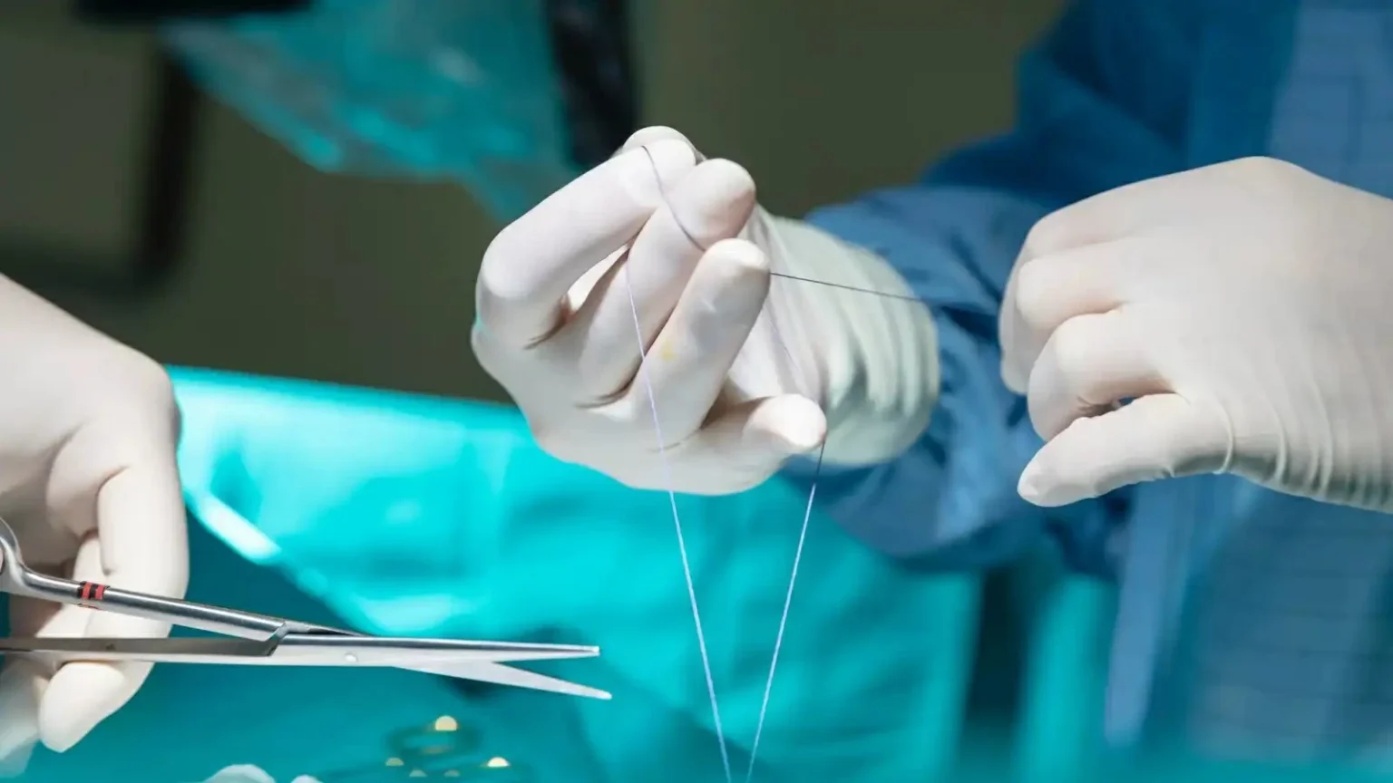 طاولة التجميل تبتلع طبيبة.. كيف ماتت أثناء العملية؟