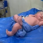 رضيع مصري يشعل مواقع التواصل بوضعية لافتة.. وطبيبه يكشف لـ«عكاظ» التفاصيل
