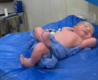 رضيع مصري يشعل مواقع التواصل بوضعية لافتة.. وطبيبه يكشف لـ«عكاظ» التفاصيل